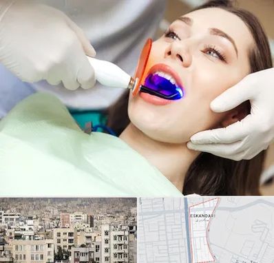 دندانپزشکی بدون درد در اسکندری