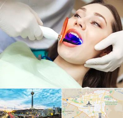 دندانپزشکی بدون درد در تهران