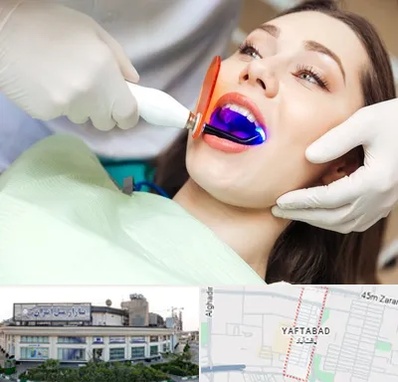 دندانپزشکی بدون درد در یافت آباد