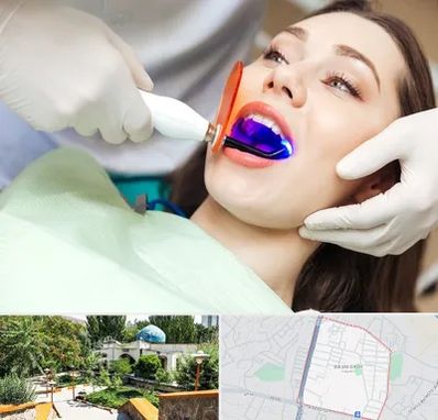 دندانپزشکی بدون درد در باغمیشه تبریز