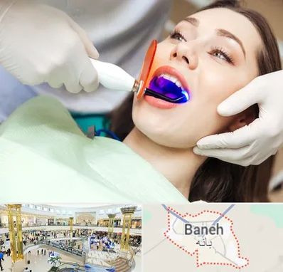 دندانپزشکی بدون درد در بانه