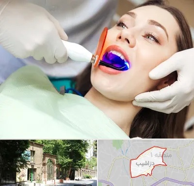 دندانپزشکی بدون درد در دزاشیب