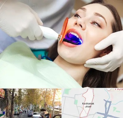 دندانپزشکی بدون درد در کاشانک