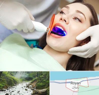 دندانپزشکی بدون درد در رویان