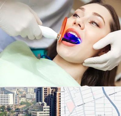 دندانپزشکی بدون درد در خیابان بهشتی