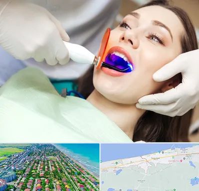 دندانپزشکی بدون درد در فریدونکنار