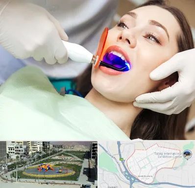 دندانپزشکی بدون درد در مرزداران تبریز