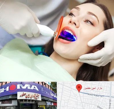 دندانپزشکی بدون درد در امین حضور