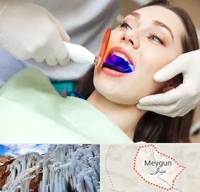 دندانپزشکی بدون درد در میگون