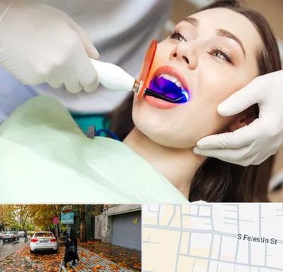 دندانپزشکی بدون درد در خیابان فلسطین