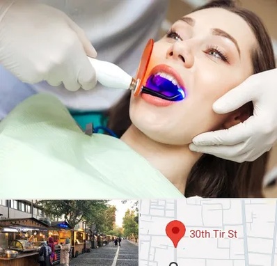 دندانپزشکی بدون درد در سی تیر