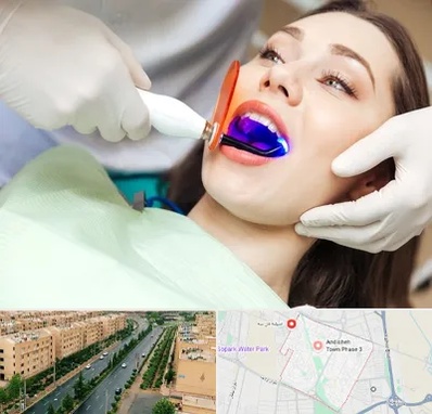 دندانپزشکی بدون درد در فاز سه اندیشه