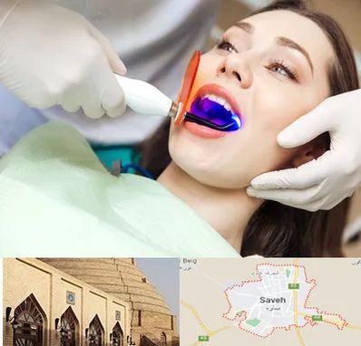 دندانپزشکی بدون درد در ساوه