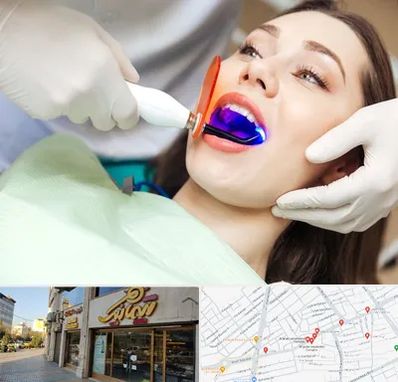 دندانپزشکی بدون درد در عطاران قم