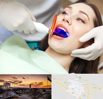 دندانپزشکی بدون درد در قوچان