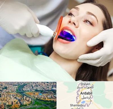 دندانپزشکی بدون درد در اردبیل