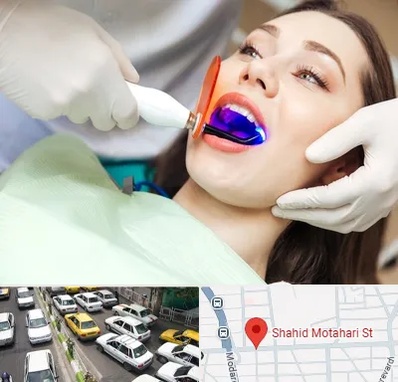 دندانپزشکی بدون درد در مطهری تهران