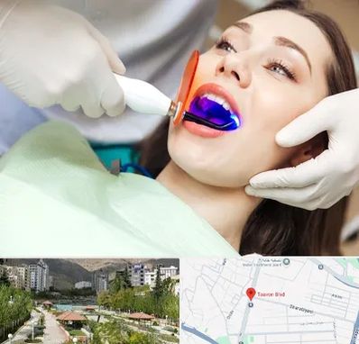 دندانپزشکی بدون درد در بلوار تعاون