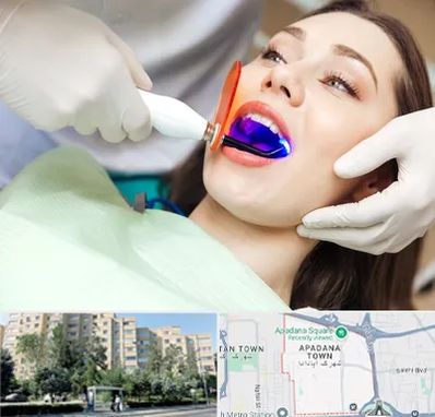 دندانپزشکی بدون درد در آپادانا