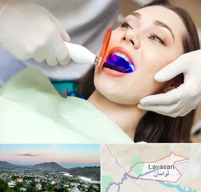 دندانپزشکی بدون درد در لواسان