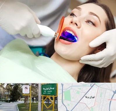 دندانپزشکی بدون درد در تهران ویلا