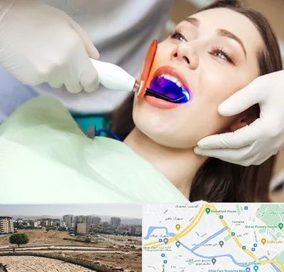 دندانپزشکی بدون درد در کوی وحدت شیراز