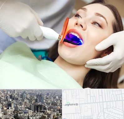 دندانپزشکی بدون درد در جیحون