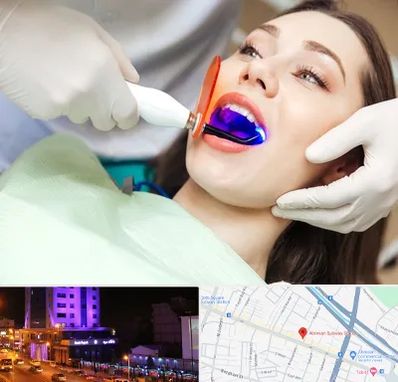 دندانپزشکی بدون درد در آبرسان تبریز