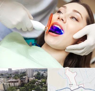 دندانپزشکی بدون درد در اوین