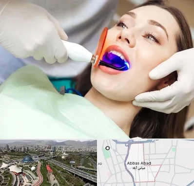 دندانپزشکی بدون درد در عباس آباد تهران