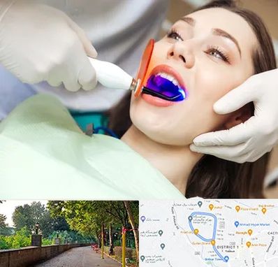دندانپزشکی بدون درد در بلوار گیلان رشت