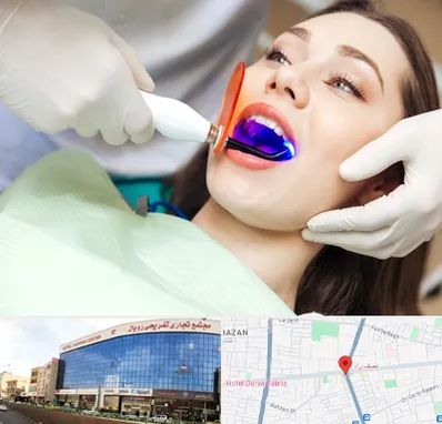 دندانپزشکی بدون درد در نصف راه تبریز