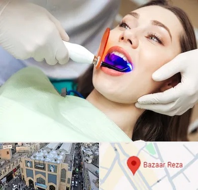 دندانپزشکی بدون درد در بازار رضا مشهد