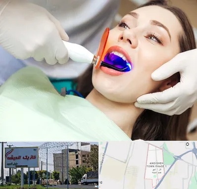 دندانپزشکی بدون درد در فاز یک اندیشه