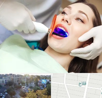 دندانپزشکی بدون درد در فلاح