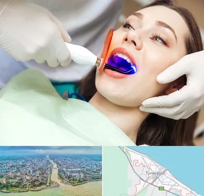 دندانپزشکی بدون درد در تنکابن