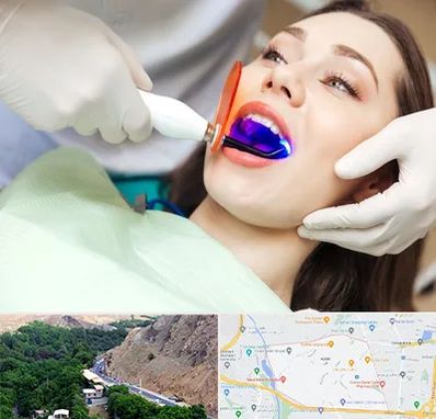 دندانپزشکی بدون درد در کن