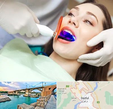 دندانپزشکی بدون درد در دزفول