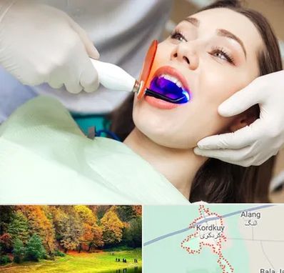 دندانپزشکی بدون درد در کردکوی