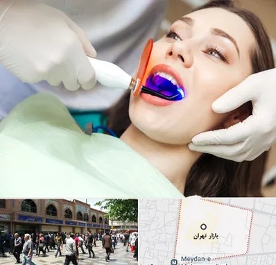 دندانپزشکی بدون درد در بازار تهران