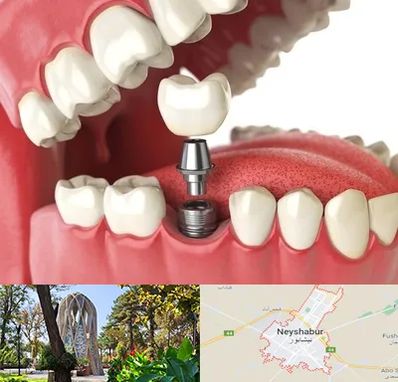 متخصص پرتز دندان در نیشابور
