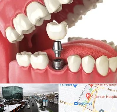 متخصص پروتز دندان در اقدسیه