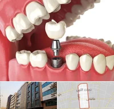 متخصص پروتز دندان در نجات اللهی