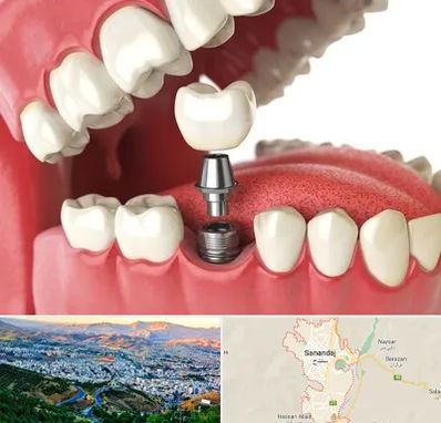 متخصص پروتز دندان در سنندج