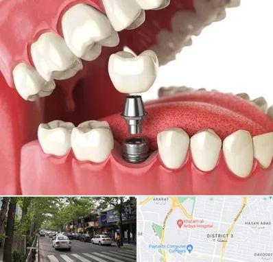 متخصص پروتز دندان در ظفر