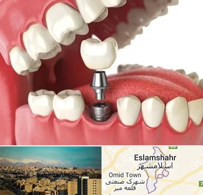 متخصص پروتز دندان در اسلامشهر