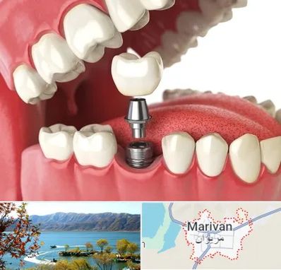 متخصص پروتز دندان در مریوان
