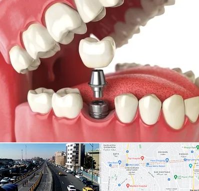 متخصص پروتز دندان در پیروزی