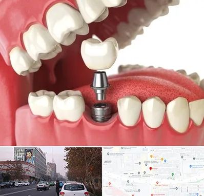 متخصص پروتز دندان در کارگر شمالی