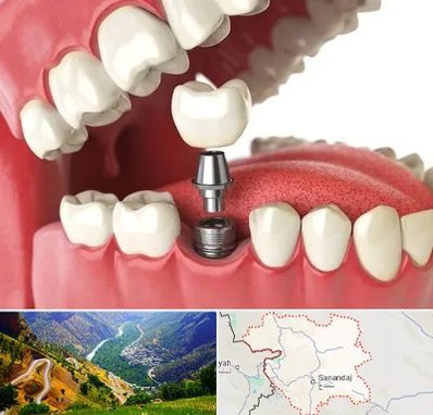 متخصص پروتز دندان در کردستان